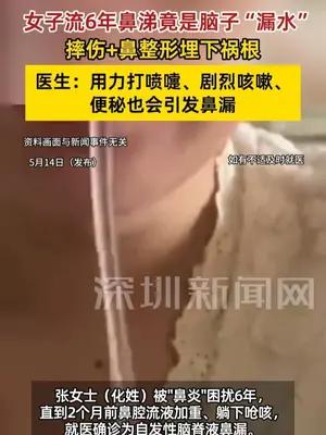 女子流6年鼻涕竟是脑子“漏水” 医生：用力打喷嚏、便秘也会引发鼻漏