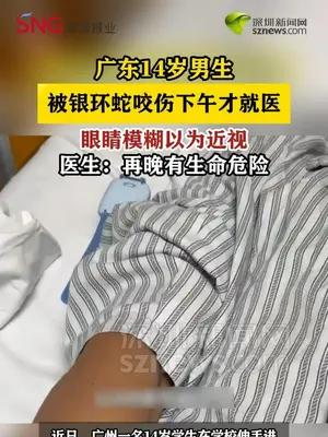 广东14岁男生被被银环蛇咬后眼睛模糊，误以为近视下午才就医