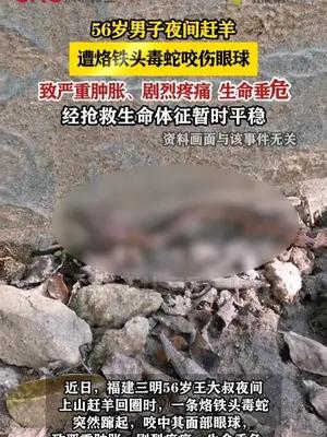 56岁男子夜间赶羊遭烙铁头毒蛇咬伤眼球