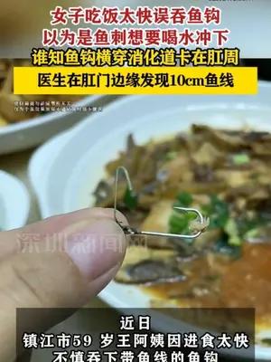 女子误吞鱼钩卡在肛门，医生在肛门边缘发现10cm鱼线