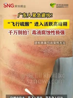 夏季广东隐翅虫活跃，别拍！毒液如“飞行硫酸”，可致失明