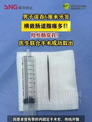 男子误吞6厘米牙签，腹痛多日险些肠穿孔，医生联合手术成功取出