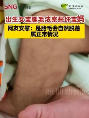 出生女宝腿毛浓密愁坏宝妈 网友安慰：是胎毛会自然脱落