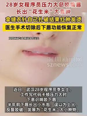 28岁女程序员总咬嘴唇长出“花生米”大囊肿