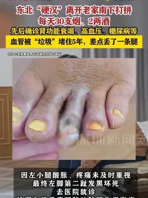 东北“硬汉”每天30支烟、2两酒，差点丢了一条腿
