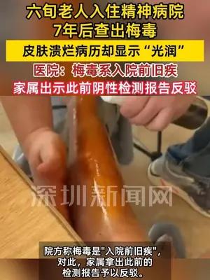 六旬老人入住精神病院7年后查出梅毒