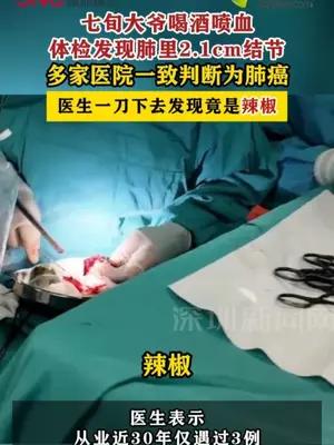 七旬大爷被多家医院诊断为肺癌，手术时发现肿瘤竟是辣椒