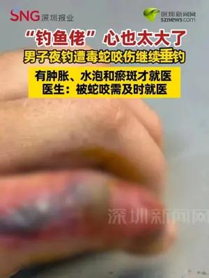 钓鱼佬心太大！男子夜钓遭毒蛇咬伤继续垂钓 有中毒症状才就医