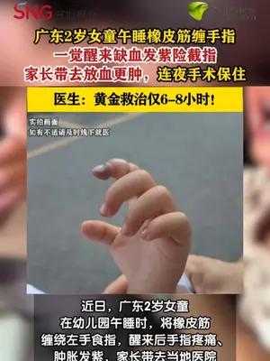 2岁女童橡皮筋缠手指致红肿，家长带其放血后险些截指