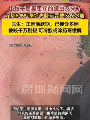 8岁娃公园光膀玩耍被蠓虫咬伤