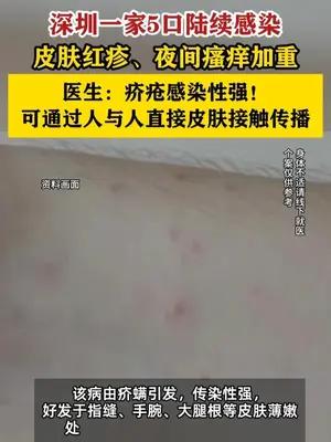 深圳一家5口陆续感染，皮肤红疹、夜间瘙痒加重