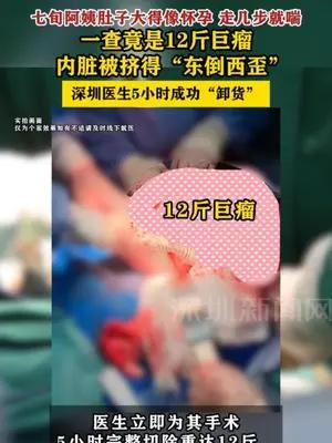 七旬阿姨肚子大得像怀孕，一查竟是12斤巨瘤
