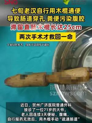 七旬老汉自行用25cm木棍通便导致肠道穿孔